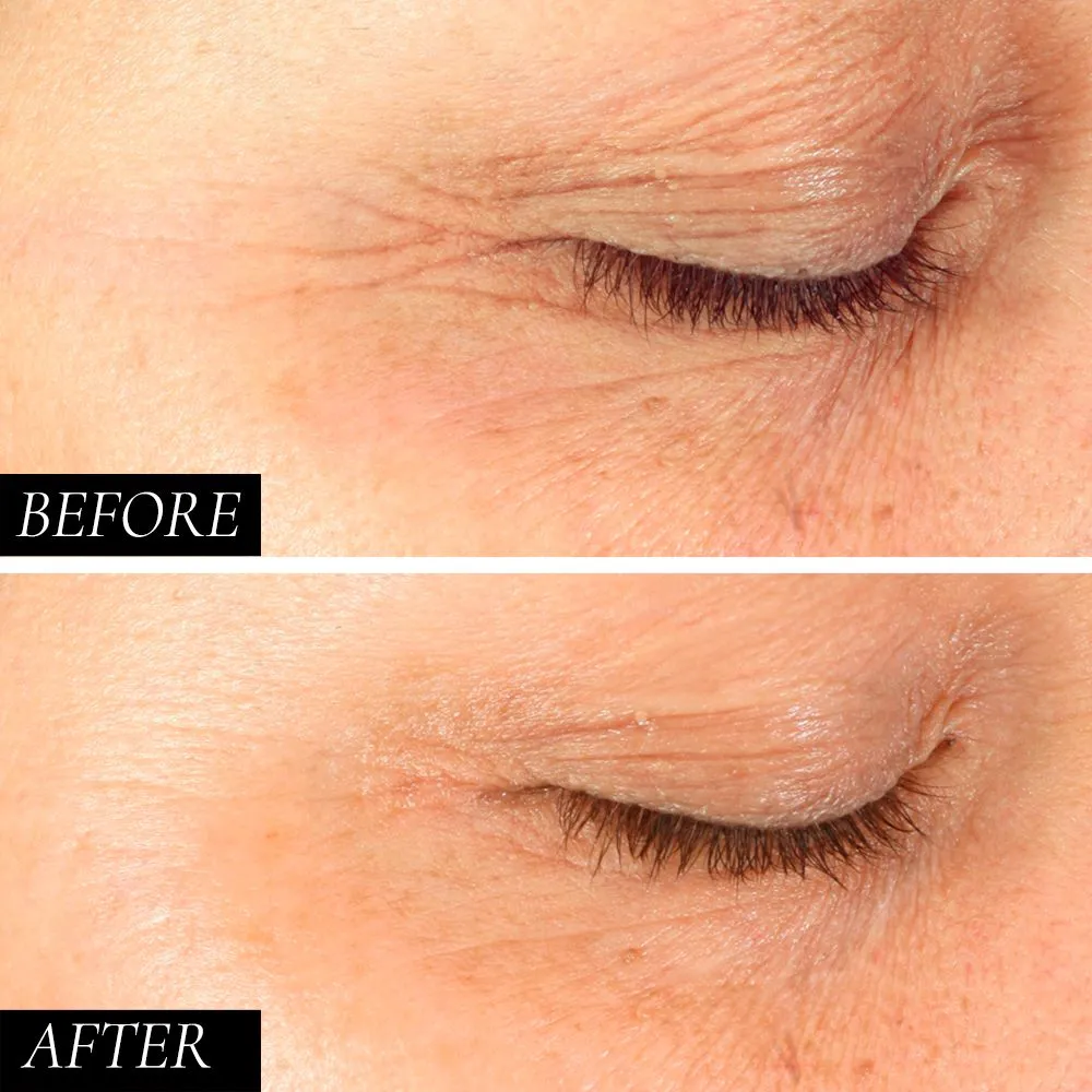 Diamond Contour Ultimate Hydration Firming Eye Serum