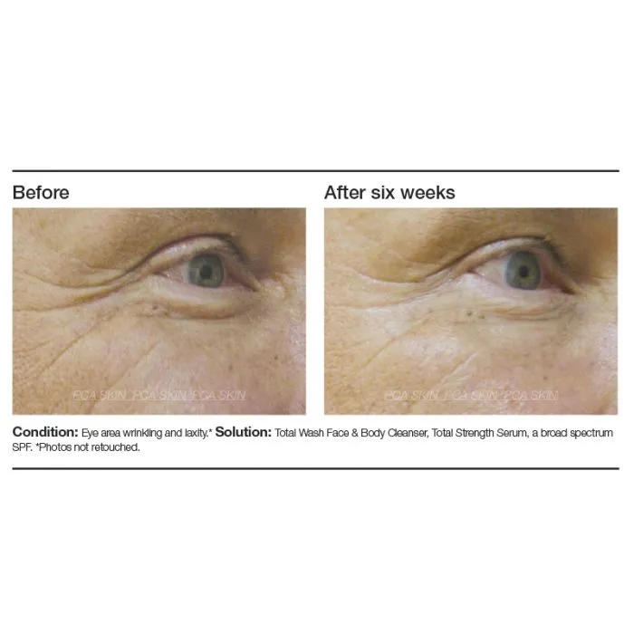 PCA Skin Total Strength Serum